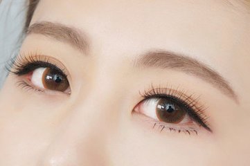 武漢切開法雙眼皮多少錢？