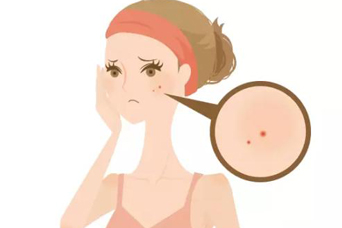 常州復(fù)合彩光祛痘印術(shù)后效果好嗎？