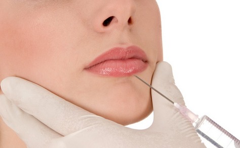 玻尿酸豐唇優(yōu)點有什么？要多少錢？