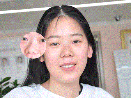 “奶茶妹妹”親姐花24萬(wàn)整容