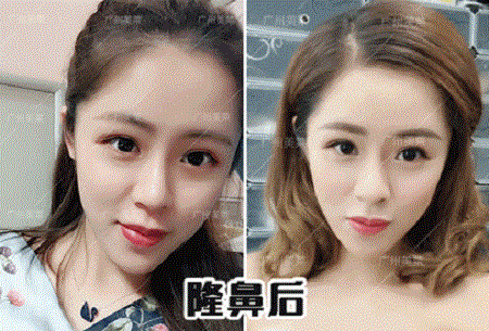 塌鼻土妞到洋氣時(shí)尚，只差1個(gè)鼻的距離！