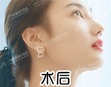  你與仙女只差一個(gè)鼻子的距離！