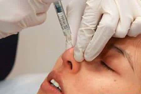 注射玻尿酸隆鼻能維持多少個(gè)月？