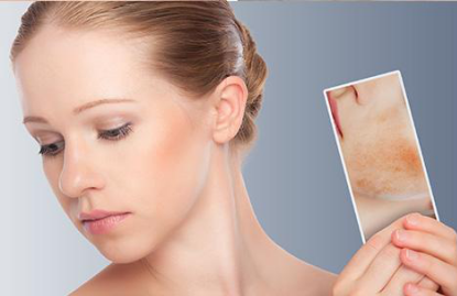 祛黃褐斑的價格大概是多少？