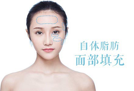 抽脂填充價(jià)格是多少？