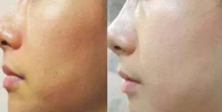 才是SK2+HR+Lamer組成的王炸！