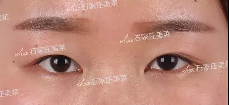 這些眼睛一點(diǎn)都不招人喜歡！