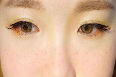臉上長(zhǎng)斑
