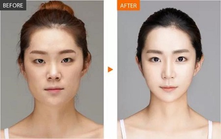  23-24日，韓國較會(huì)整容的柳元敏博士，來了！