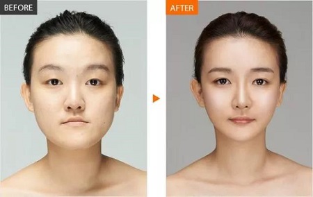  23-24日，韓國較會(huì)整容的柳元敏博士，來了！