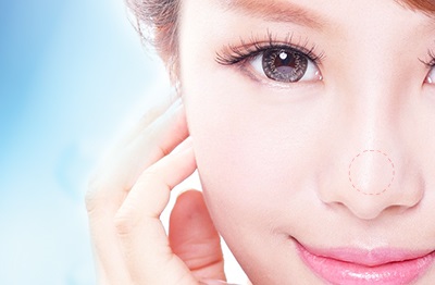 隆鼻修復(fù)手術(shù)要多少錢？