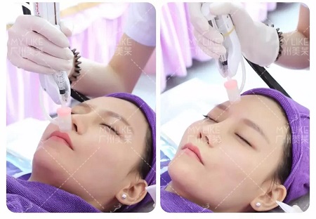 水光、紋眉￥199，超值秒殺拼團(tuán)，千萬(wàn)別走寶！