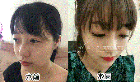 來(lái)battle呀！雙眼皮效果到底好不好？