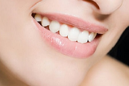 嘴角上揚術(shù)