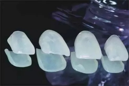 牙貼面的護(hù)理很重要，要不然黑牙愛你沒商量！