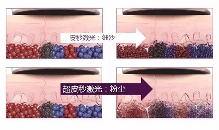 關(guān)于祛斑，可不能用美圖秀秀、輕顏相機、無他相機麻痹自己！