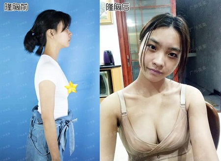 專(zhuān)業(yè)打假！所謂的豐胸秘籍是什么？！