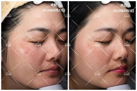 防黑！防黃！還要防色斑！這個(gè)“小瓶子”你值得擁有！