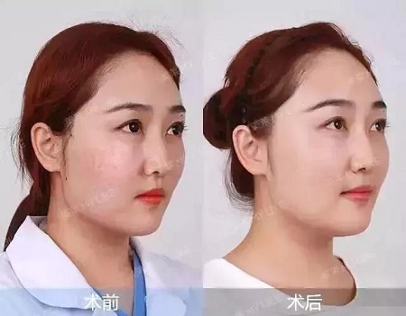 賦活水光3次399元、水光針買一送一...春季水光專場，爆款限時搶！