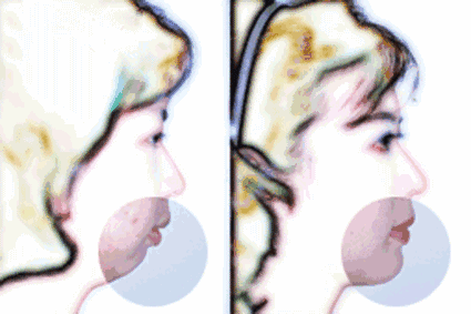 從“側(cè)顏癱”到“側(cè)顏殺”，其實(shí)只需要一點(diǎn)小改變