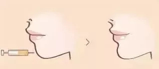 從“側(cè)顏癱”到“側(cè)顏殺”，其實(shí)只需要一點(diǎn)小改變