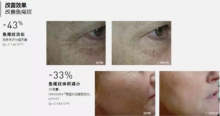 抗衰老的“水光”究竟為何飽受稱贊？