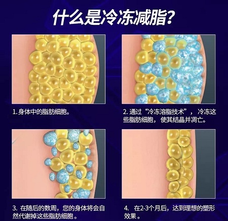 瘦身Flag挑戰(zhàn)賽 | “躺著就能瘦”真的不是夢(mèng)，人人都可以！