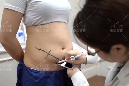 瘦身Flag挑戰(zhàn)賽 | “躺著就能瘦”真的不是夢(mèng)，人人都可以！