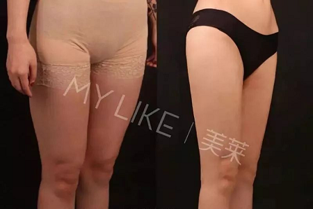 瘦身Flag挑戰(zhàn)賽 | “躺著就能瘦”真的不是夢(mèng)，人人都可以！