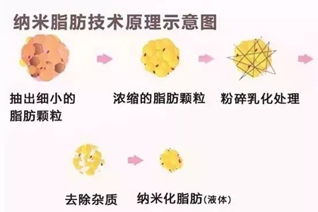 拿什么拯救你，我的黑眼圈？