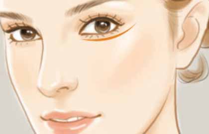 墊鼻子手術(shù)價格是多少?