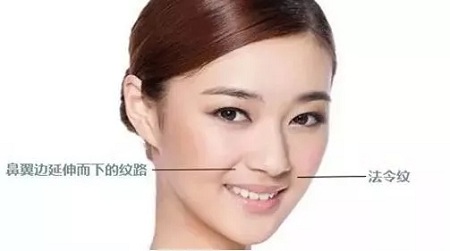 法令紋、川字紋