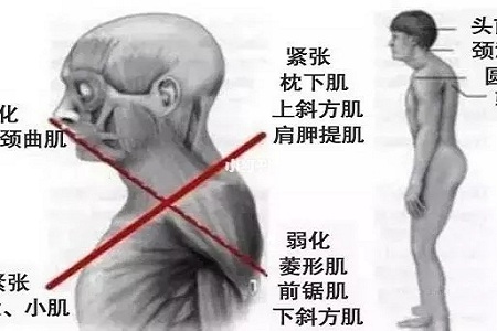 聽說很多不敢露胳膊的女生，胳膊上都有這個bug