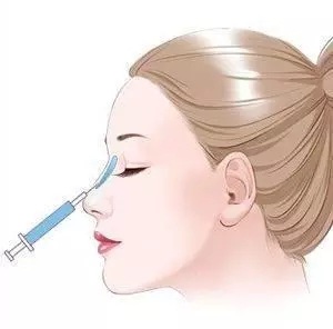 什么，隆鼻方式竟然有這么多種？