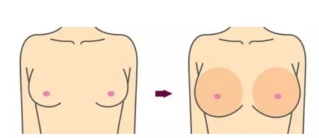 問診室：關(guān)于脂肪的變廢為寶，你了解嗎？