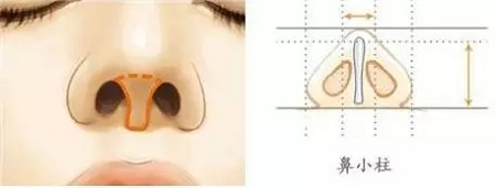 糾結！鼻頭太圓想塑形是用肋軟骨還是耳軟骨好？