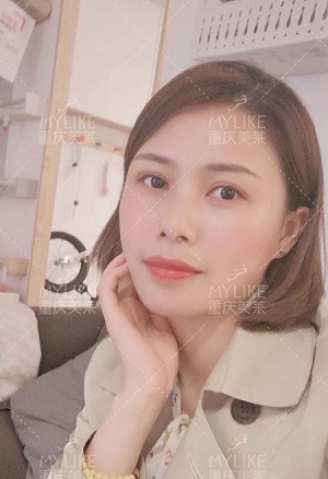 讓明星“一夜回春”的自體脂肪到底適不適合你？