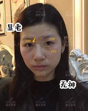 市面上五花八門的雙眼皮項目，如何有效找到你的菜？