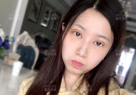 市面上五花八門的雙眼皮項目，如何有效找到你的菜？