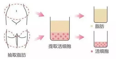 美萊實驗室：當顏值遇上“胸”霸，男人一般都會怎么選？