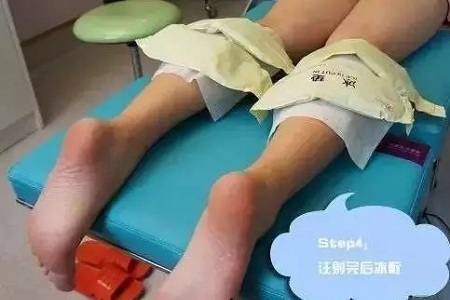 這有一個快速又持久瘦小腿的方法！請注意查收！