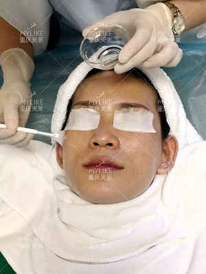 那個(gè)斑點(diǎn)女孩后來怎么樣了？