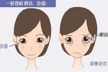美萊實(shí)驗(yàn)室：分型祛除眼袋，拒絕+10歲