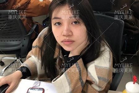 大小眼、不對(duì)稱，你是長(zhǎng)胖了還是真老了？