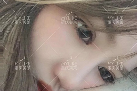 大小眼、不對(duì)稱，你是長(zhǎng)胖了還是真老了？