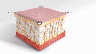 明星的臉和你的臉差的只是這一步！--面部脂肪填充