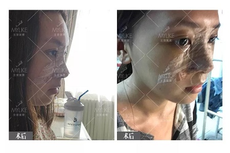 顏值：鼻子一小步，顏值一大步~