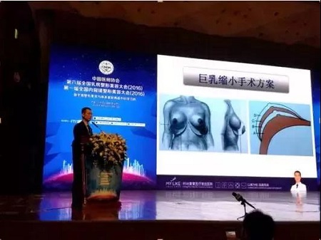 如果你認(rèn)識(shí)栗勇，你一定知道假體隆胸