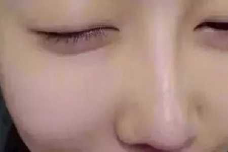 水光，打1次和4次究竟有多大區(qū)別？