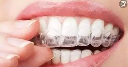 問診室：關(guān)于正畸，不止你想的這么簡單喔